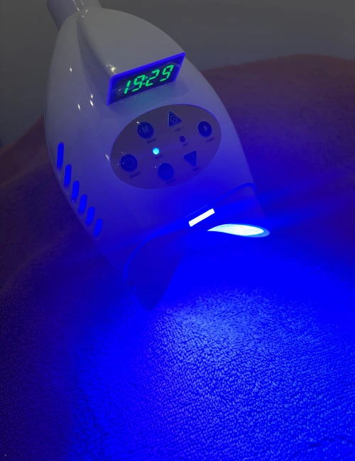 lampe d'éclaircissement dentaire à hulluch body mind